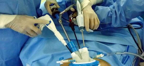 بازرگانی خرید غلاف بدون چاک انتقال جنین