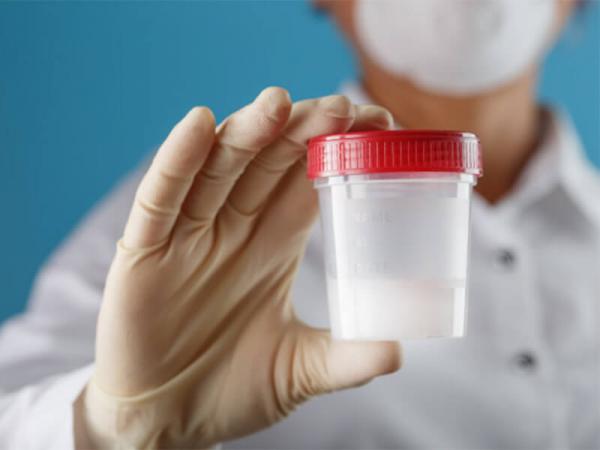 قیمت انواع پایوت ذخیره اسپرم یک چهارم