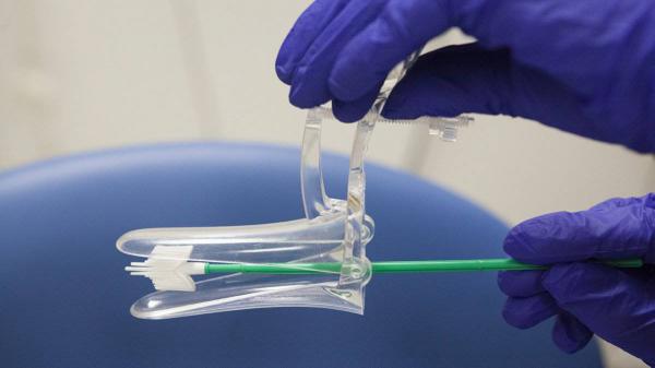 کارایی زیاد اسپیکولوم ساده