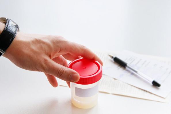 تولید کننده ست جمع آوری اسپرم ایرانی