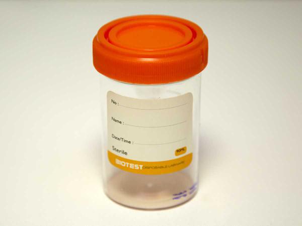 تولید کننده ست جمع آوری اسپرم ایرانی