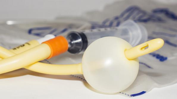 کارایی کاتتر شستو شوی رحم چیست؟