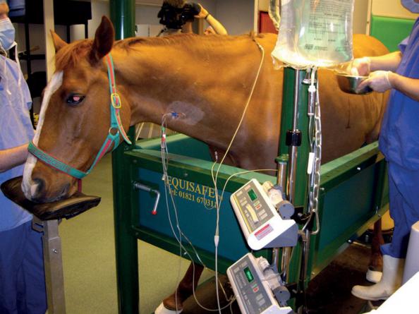 طریقه استفاده صحیح از کاتتر شستو شوی