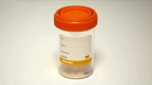 ست جمع آوری اسپرم چه کارایی دارد؟